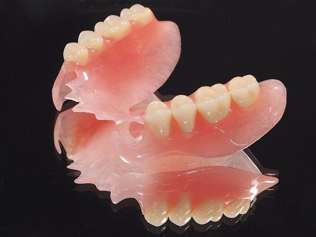 ノンクラスプの入れ歯