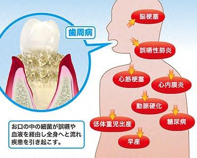 全身へのリスク